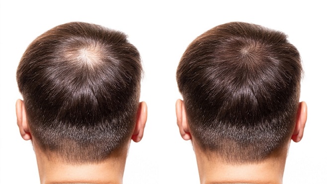 Jak działa Dense Hair? Poznaj efekty